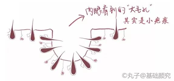 毛孔粗大到能插秧4招教你缩回去,脸上毛孔粗大跟插秧一样