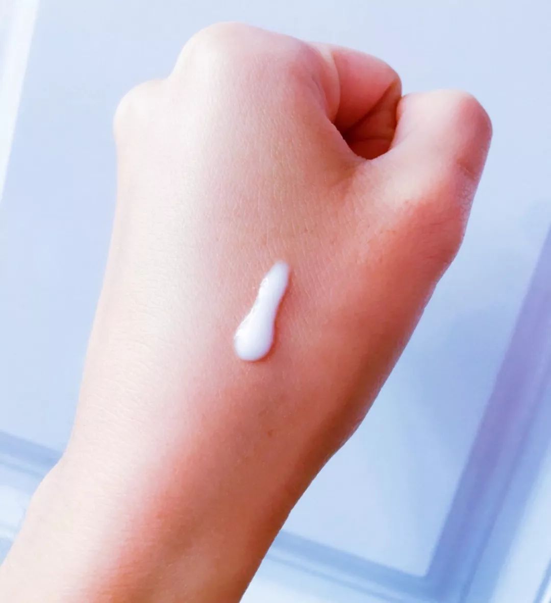 祛痘药膏指南,国内祛痘绝招排名榜最新