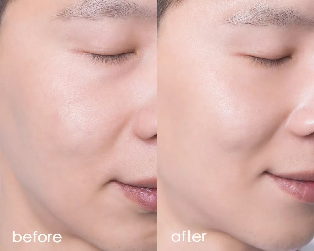 不要做无效护肤,你是否还在无效护肤