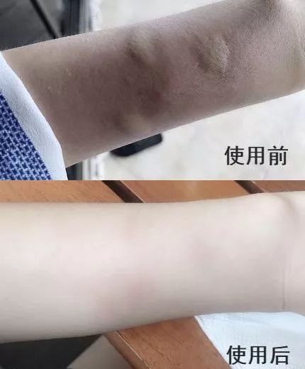 泰国驱蚊青草膏,驱蚊神器第一名青草膏