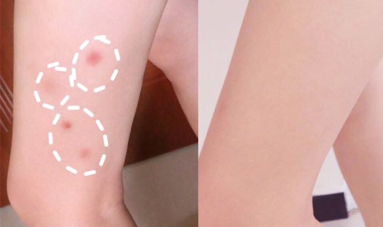 泰国驱蚊青草膏,驱蚊神器第一名青草膏