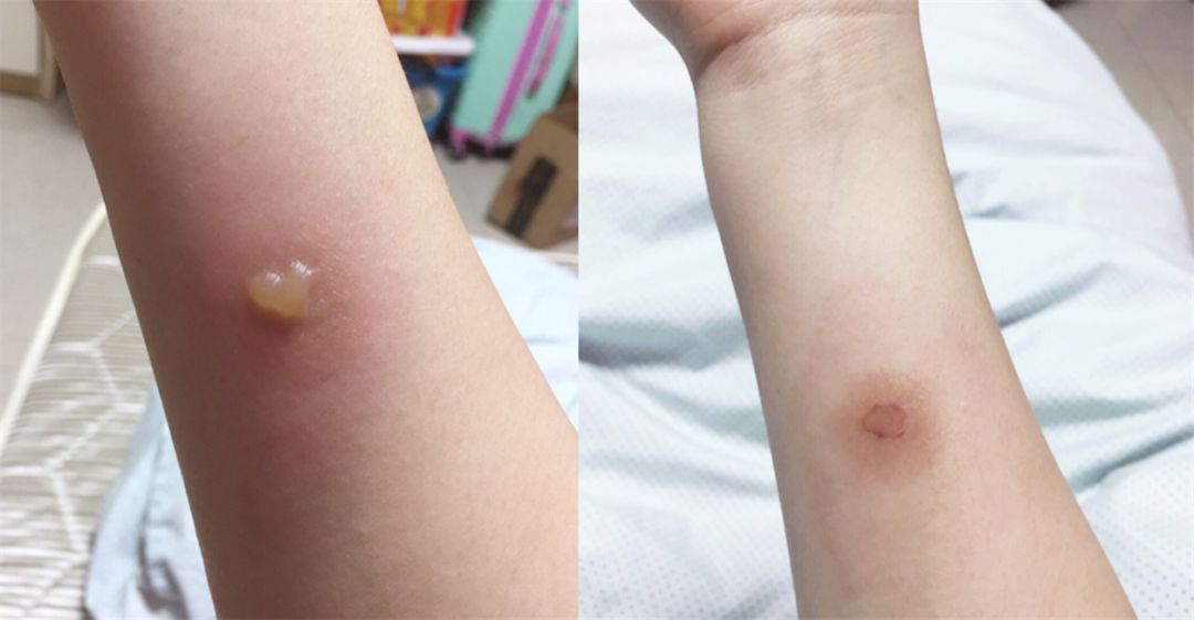 泰国驱蚊青草膏,驱蚊神器第一名青草膏