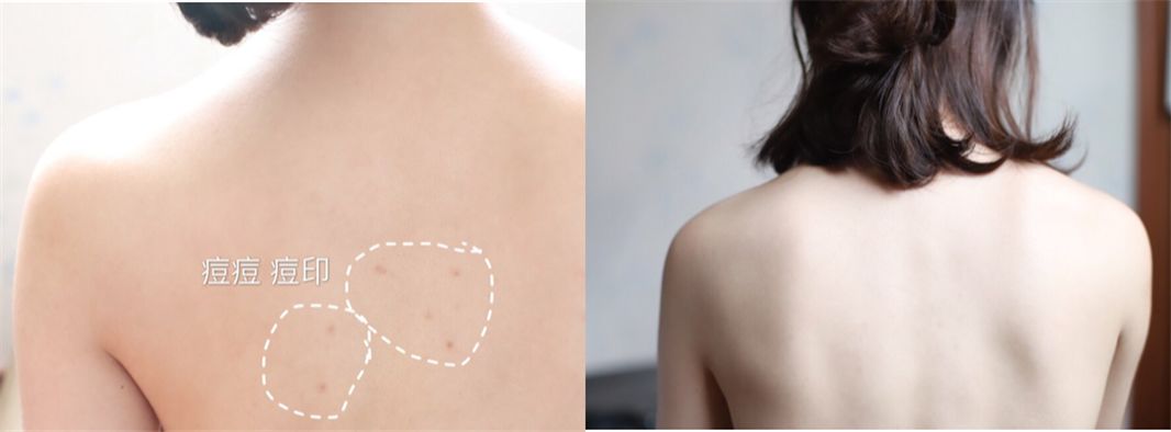 泰国驱蚊青草膏,驱蚊神器第一名青草膏