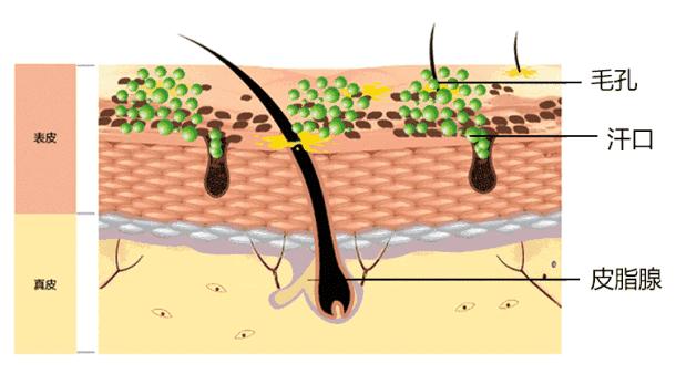 鸡皮肤怎么穿露背装,短期内快速去除鸡皮肤