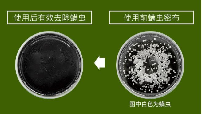头皮除螨虫神器哪种好用,头屑头油清除神器第一名