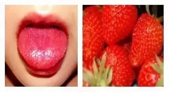 紧急提醒这些疾病已进入高发期,家长注意这种病进入高发期