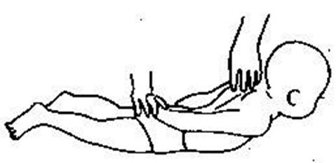 脑瘫儿童头往后仰怎么锻炼,脑瘫儿童抽搐四肢无力怎么办