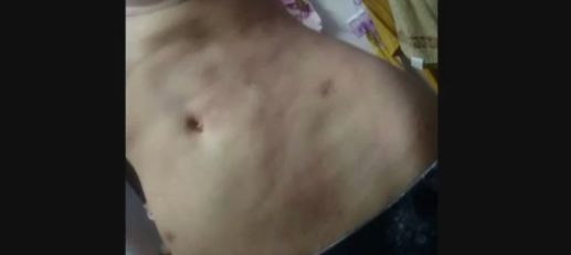 90后女孩皮肤松弛,90后女孩有半脸毁容