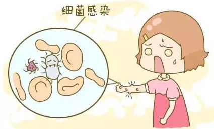 被咬伤感染狂犬病的概率,狂犬病和破伤风的表现有何不同