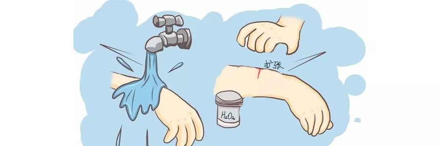 被咬伤感染狂犬病的概率,狂犬病和破伤风的表现有何不同