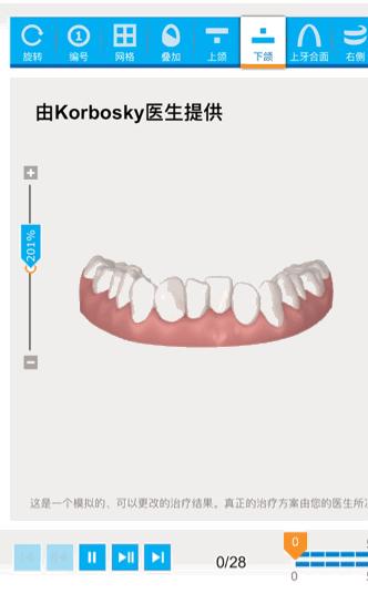 怀孕可以做乳房矫正吗,30岁哺乳期矫正牙齿的利与弊