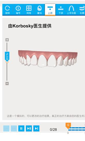 怀孕可以做乳房矫正吗,30岁哺乳期矫正牙齿的利与弊