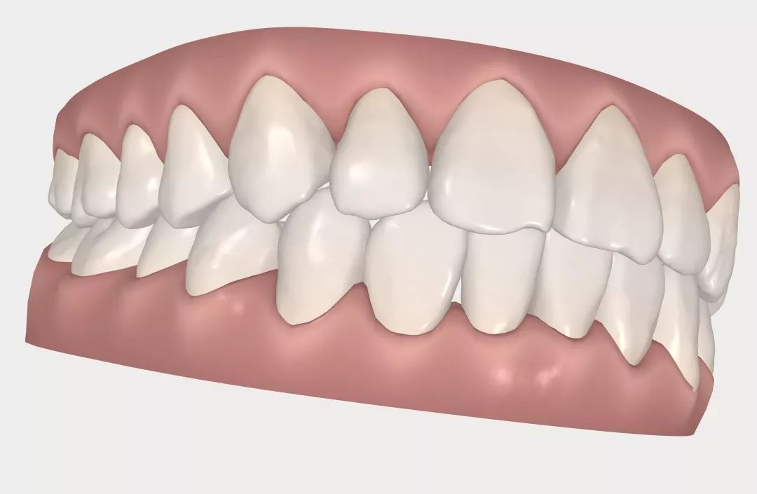 怀孕可以做乳房矫正吗,30岁哺乳期矫正牙齿的利与弊
