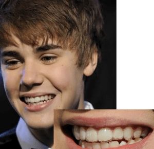 怀孕可以做乳房矫正吗,30岁哺乳期矫正牙齿的利与弊