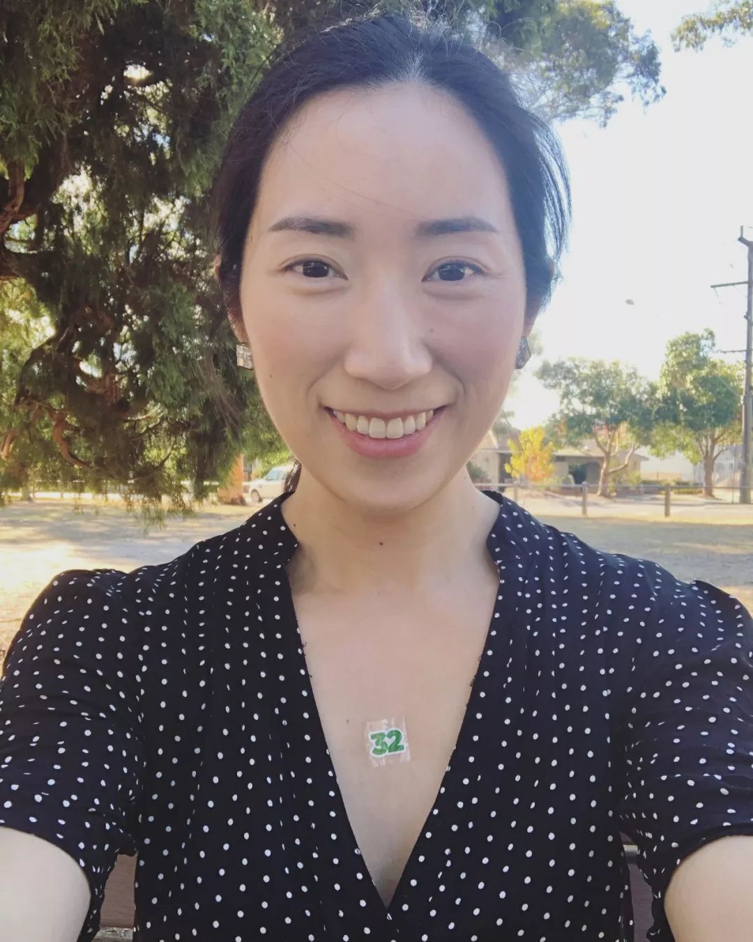 怀孕可以做乳房矫正吗,30岁哺乳期矫正牙齿的利与弊