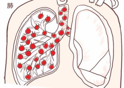 小编推荐丨缓解咳嗽、口臭,试试这个“千金方”!澳洲纯植物提取