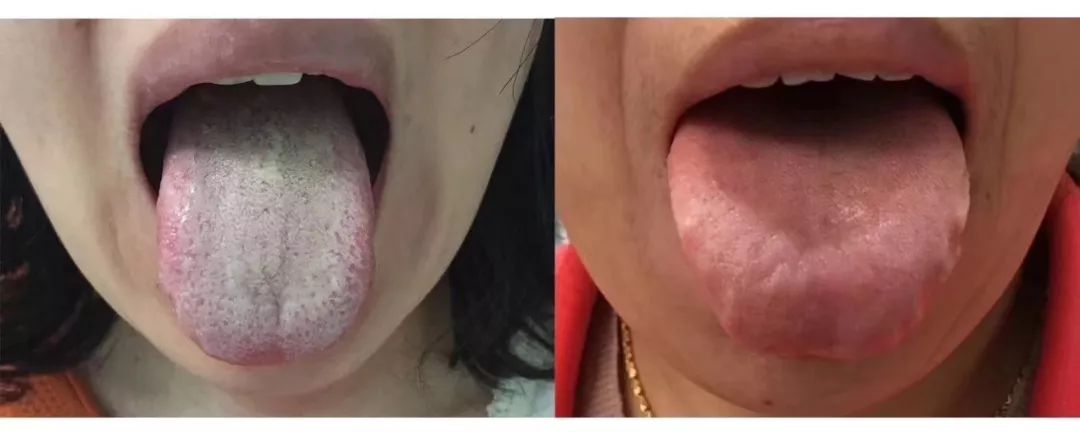 去寒去湿养生,夏季养生三步法祛湿散寒