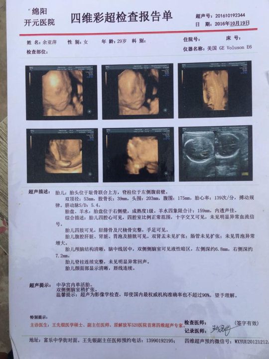 泰安漏诊畸形儿,产检正常却生出畸形儿