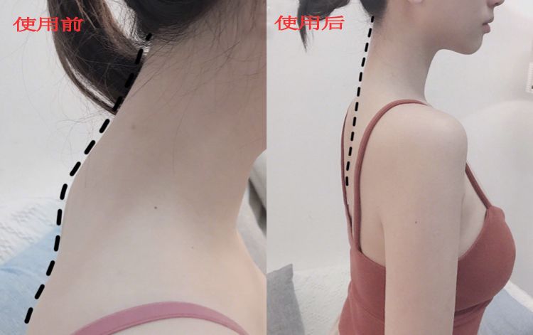 含胸驼背最损气质手把手教你纠正,含胸驼背如何改善提升气质