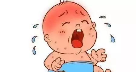 宝宝红屁股的原因和护理方法,8月龄宝宝突然红屁股怎么办