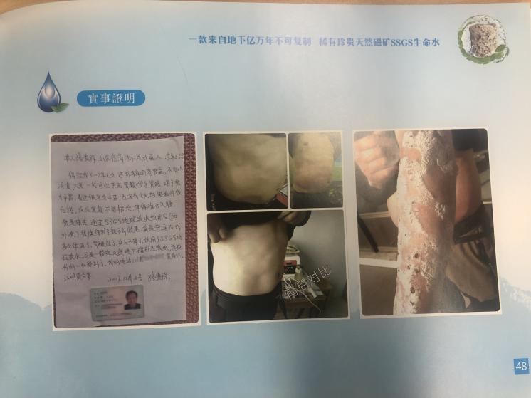 癌症、银屑病都能治？地磁泉违法宣传套路深