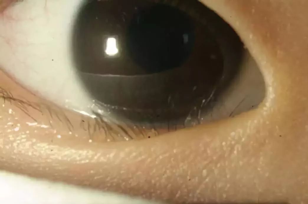 两岁宝宝睫毛往里长怎么办,两岁宝宝睫毛发黄分叉可以剪掉吗