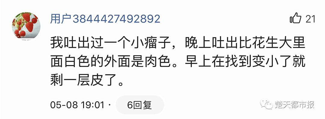 吓人！男子酒后呕吐，竟然吐出大肉团！医生：是肿瘤！还有更奇葩的