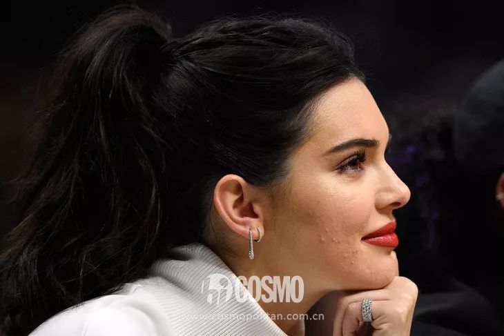 美人计|顽固一年的闭口终于在夏天之前消退了,我用了这些