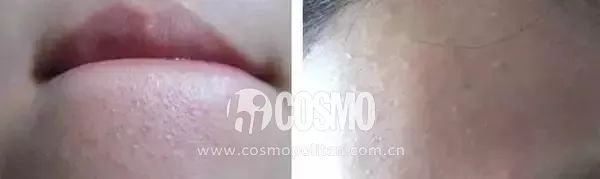 美人计|顽固一年的闭口终于在夏天之前消退了,我用了这些