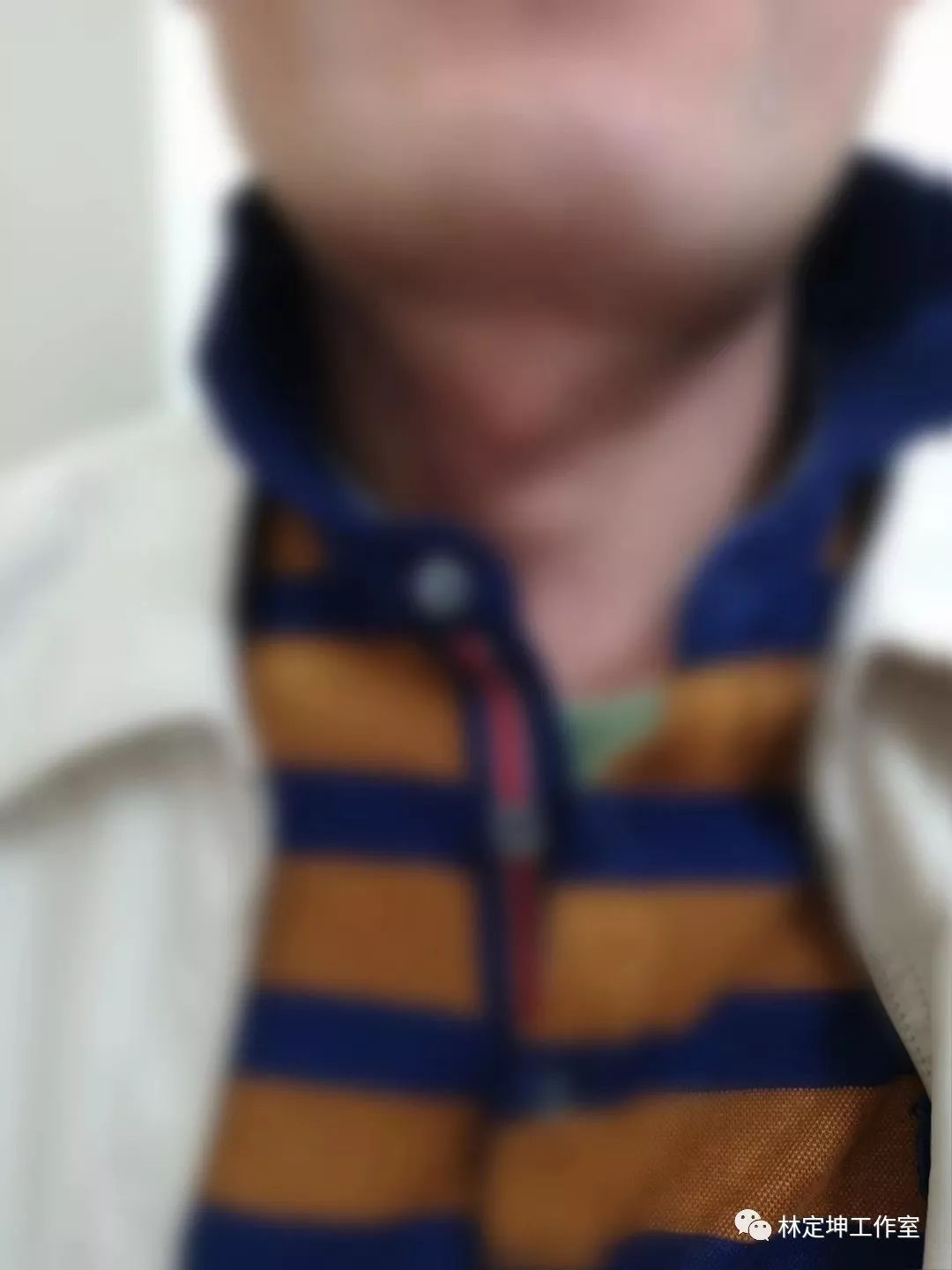 谈骨论筋和经络,谈骨论筋治疗