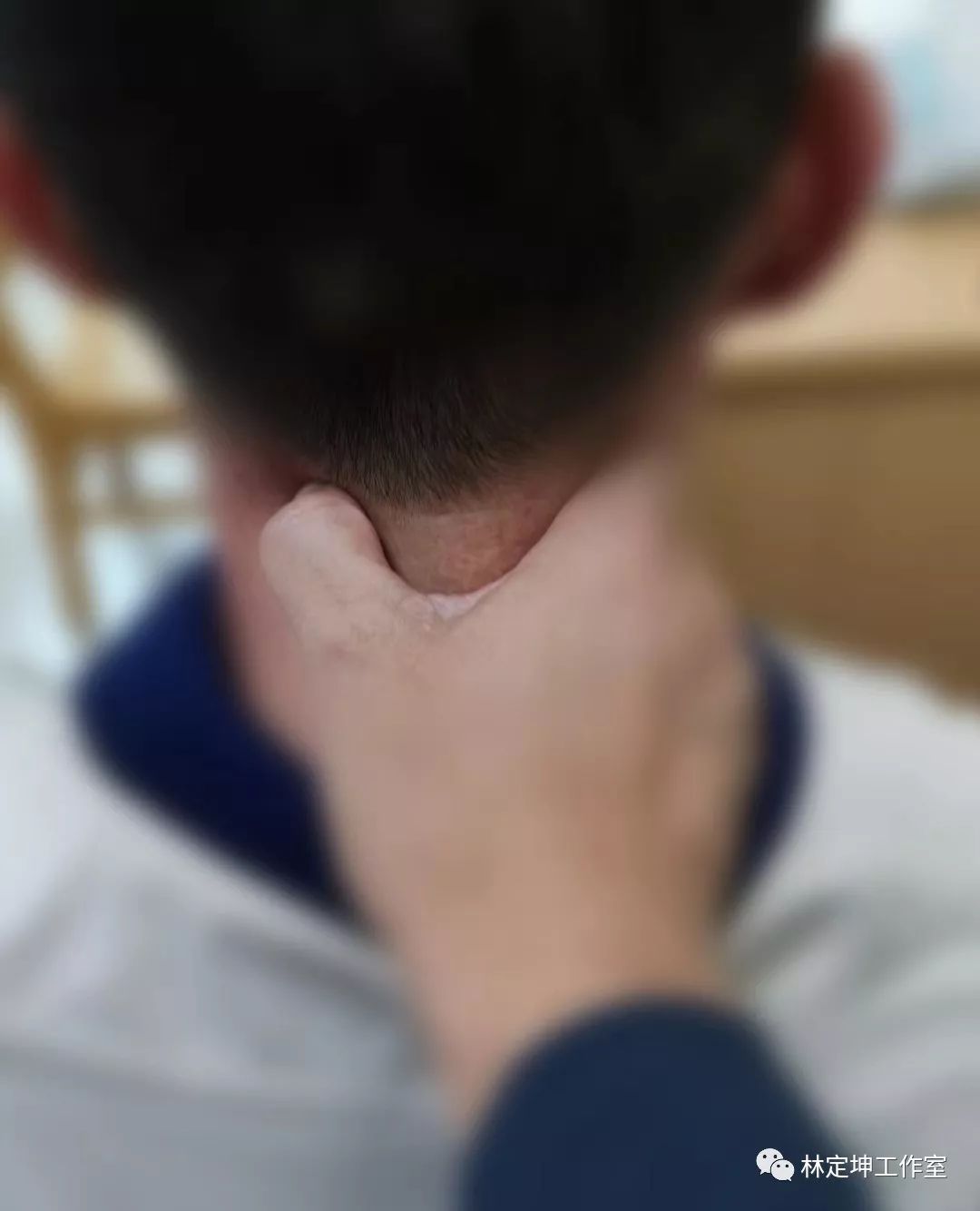 谈骨论筋和经络,谈骨论筋治疗