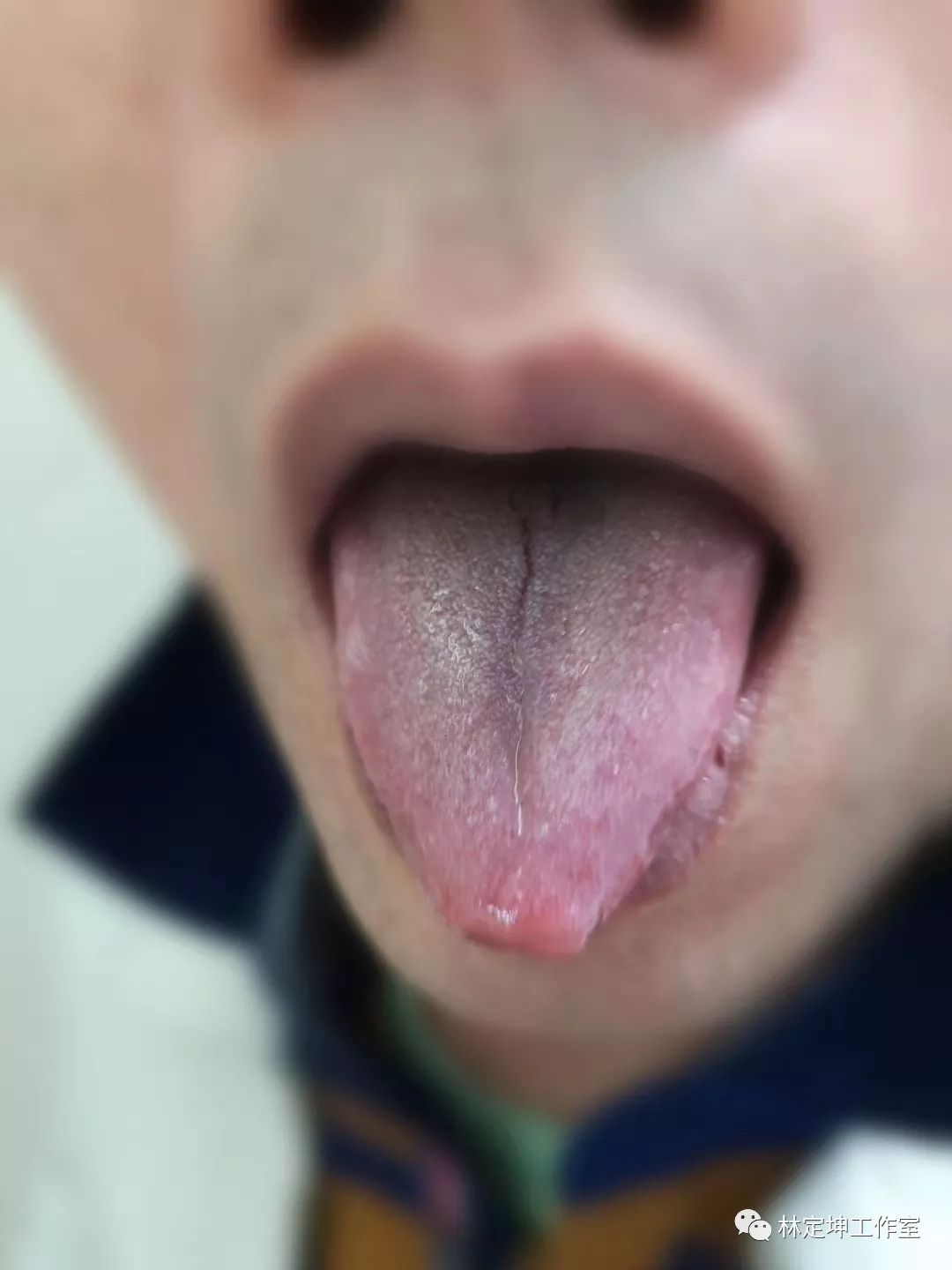 谈骨论筋和经络,谈骨论筋治疗