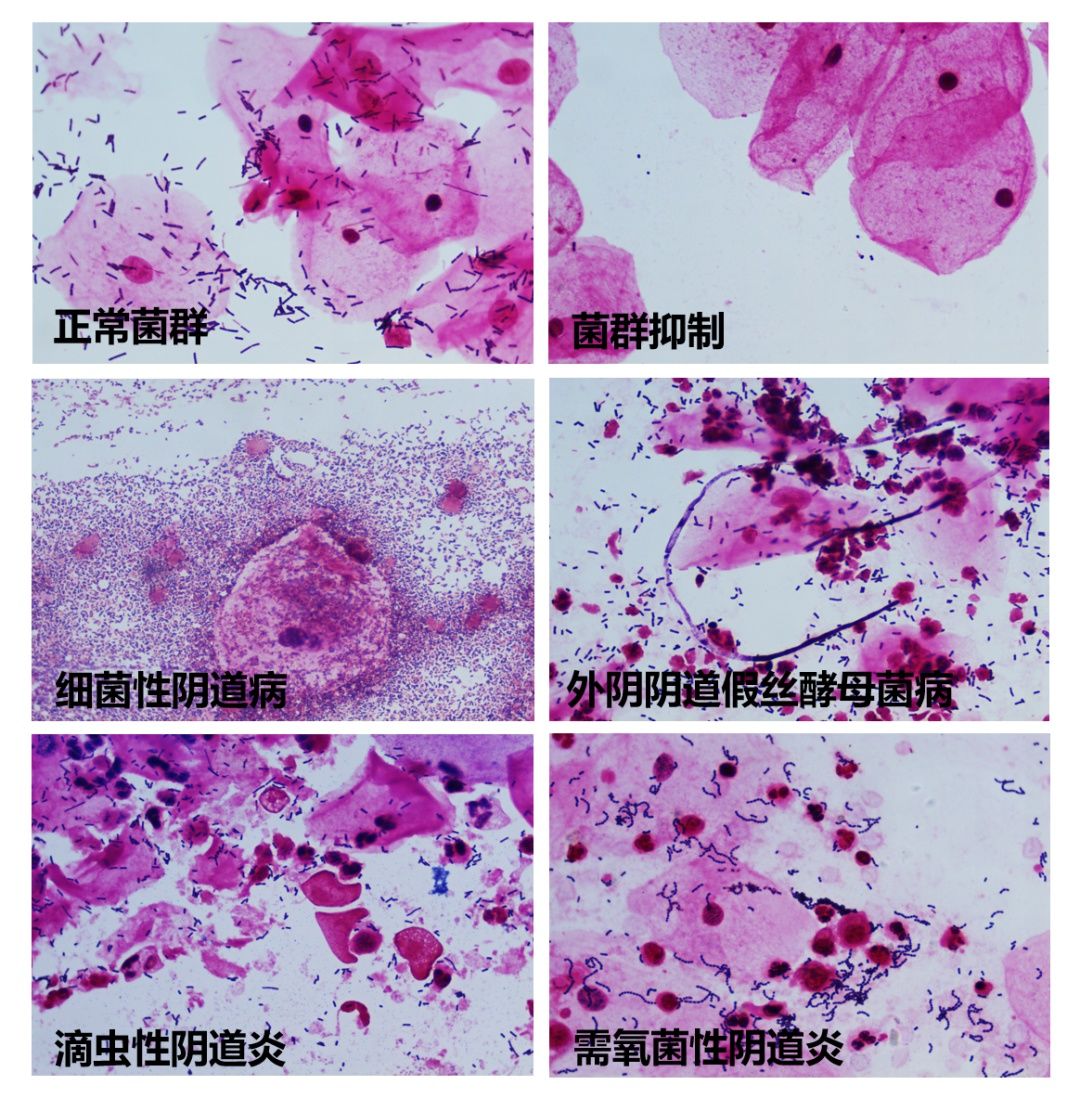 妇产医学资讯,妇产医院新资讯