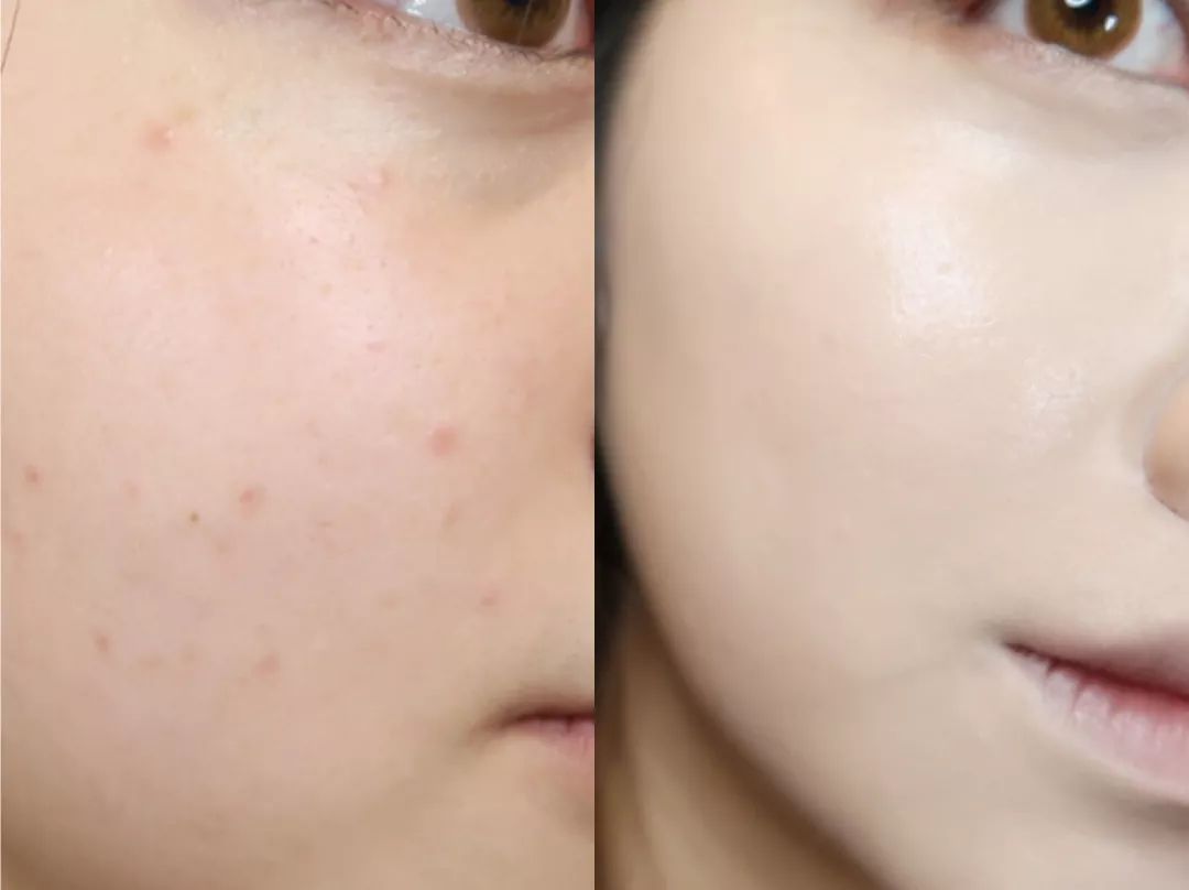 颐和园口红三款,章若楠口红镜面唇釉