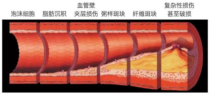 世界上最危险的烧烤,最危险的烧烤