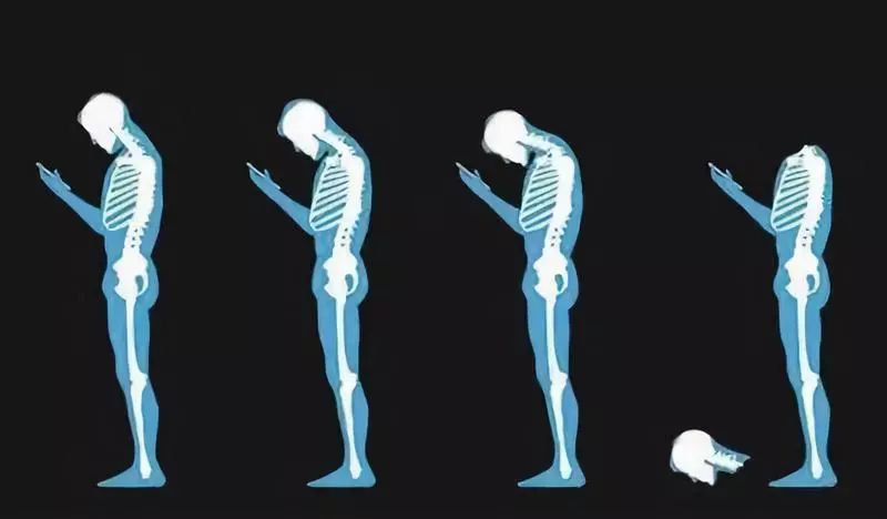 经常玩手机看书眼睛会模糊吗,爱玩手机的坏处日记