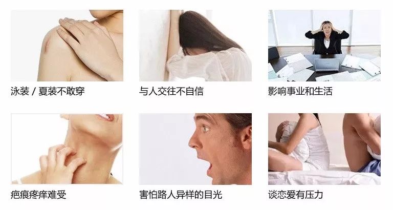 疤痕彻底消失新技术,疤痕淡化修复新技术