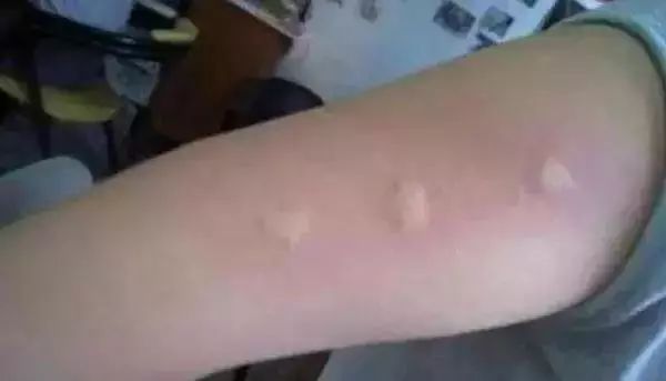 日本驱蚊好物,夏天灭蚊必备好物