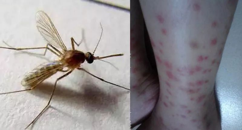 泰国蚊子叮咬止痒膏成人,蚊虫叮咬最管用泰国药膏