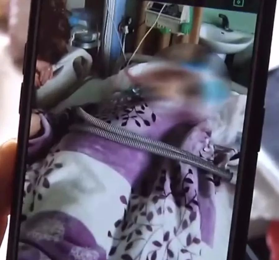 女子一觉睡醒发现老公猝死,女子睡梦中死亡原因