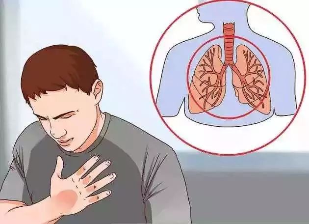 预防胸痛科普视频,健康科普冠心病护理