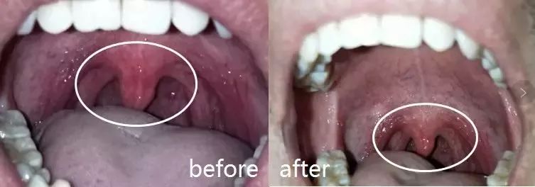 3秒清新口气口腔持久留香,3秒永久去除口臭