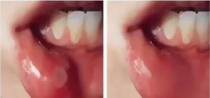 3秒清新口气口腔持久留香,3秒永久去除口臭