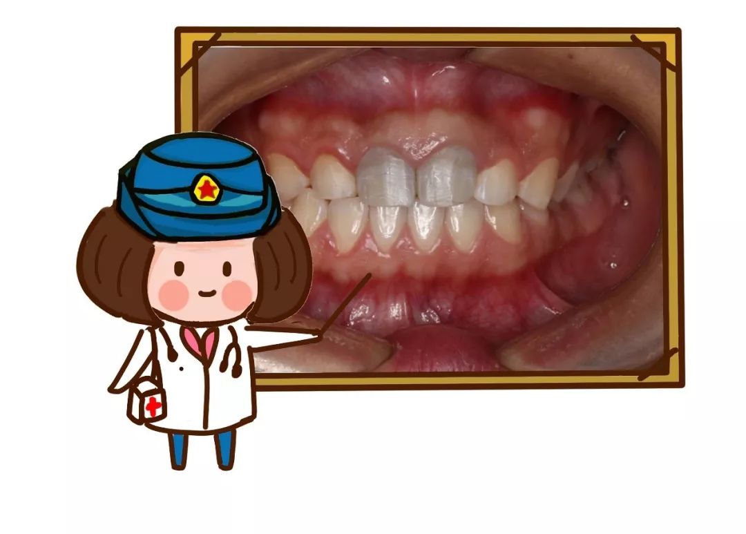 牙外伤序列治疗,军医出现医疗事故会怎么处理
