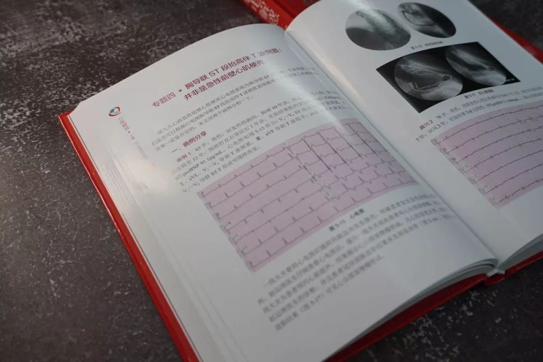 心电图的“红宝书”—《心电解惑》｜新书速递