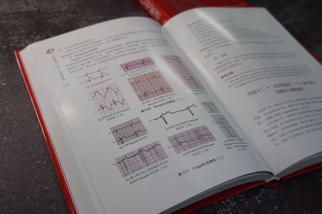心电图的“红宝书”—《心电解惑》｜新书速递