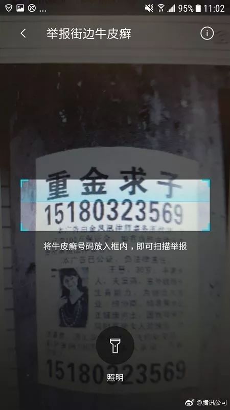 安陆治疗牛皮癣,安陆治牛皮癣的地方