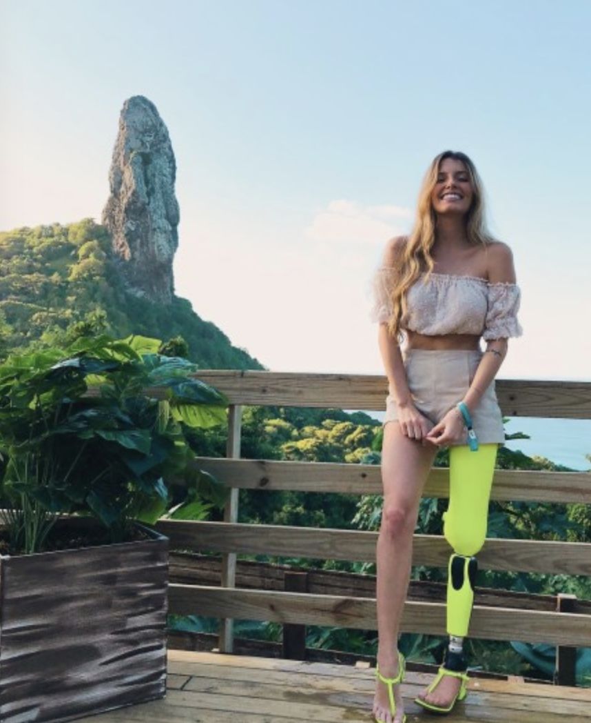 她惊艳了世界,她用自己独特的魅力征服了全世界