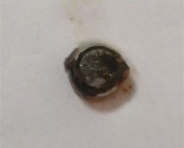 把小珠子塞耳朵里,小孩子淘气把珠子弄在耳朵里