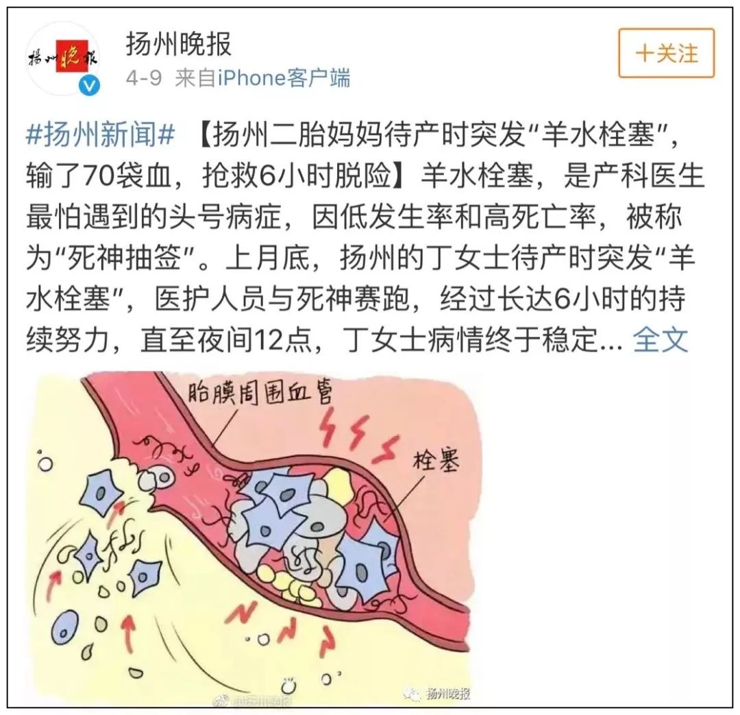 明星自曝产后后遗症,明星产后尿失禁怎么治疗